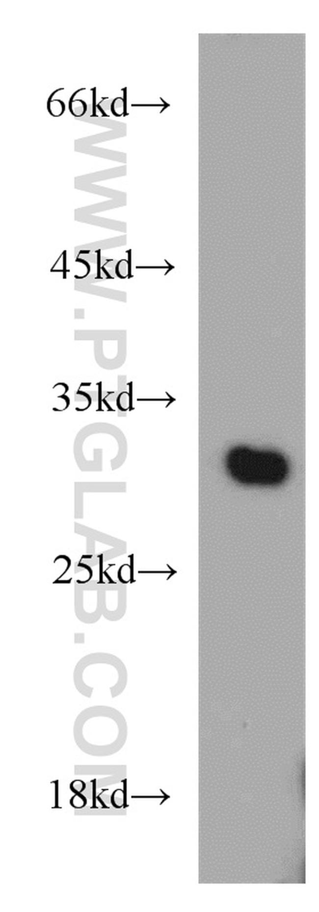 VDAC1/2 Antibody in Western Blot (WB)