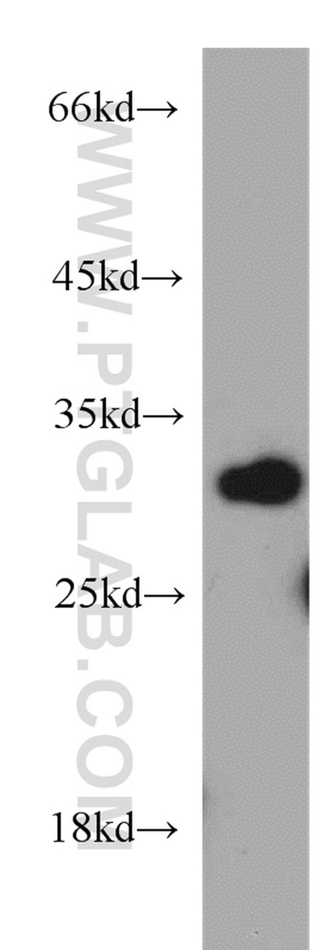 VDAC1/2 Antibody in Western Blot (WB)