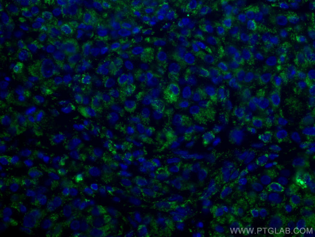 VDAC1/2 Antibody in Immunohistochemistry (PFA fixed) (IHC (PFA))