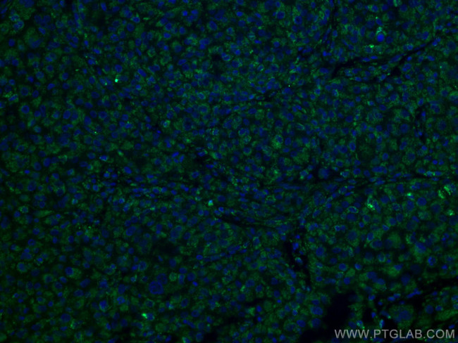 VDAC1/2 Antibody in Immunohistochemistry (PFA fixed) (IHC (PFA))