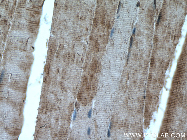 ATP1A3 (C-terminal) Antibody in Immunohistochemistry (Paraffin) (IHC (P))