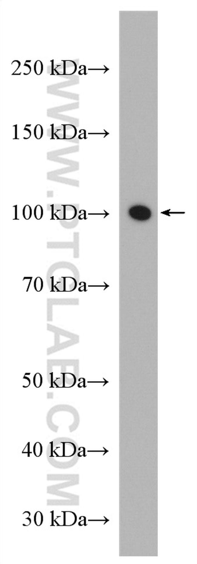 ATP1A3 (C-terminal) Antibody in Western Blot (WB)