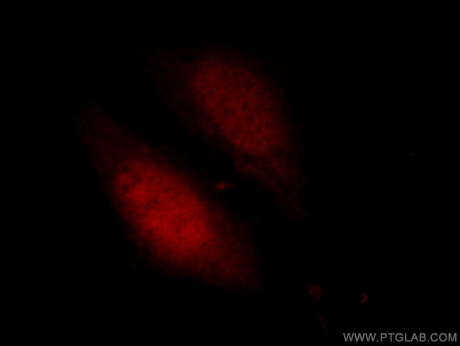 PITX1 Antibody in Immunocytochemistry (ICC/IF)