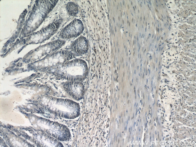 PITX1 Antibody in Immunohistochemistry (Paraffin) (IHC (P))