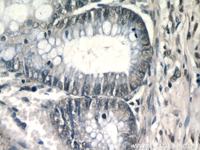 PITX1 Antibody in Immunohistochemistry (Paraffin) (IHC (P))