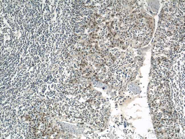 PITX1 Antibody in Immunohistochemistry (Paraffin) (IHC (P))