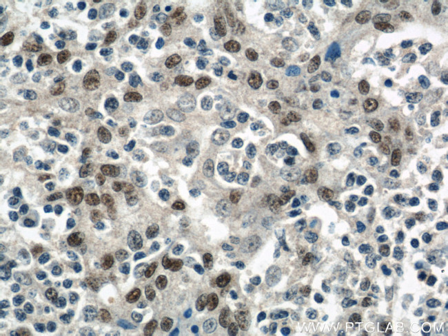 PITX1 Antibody in Immunohistochemistry (Paraffin) (IHC (P))