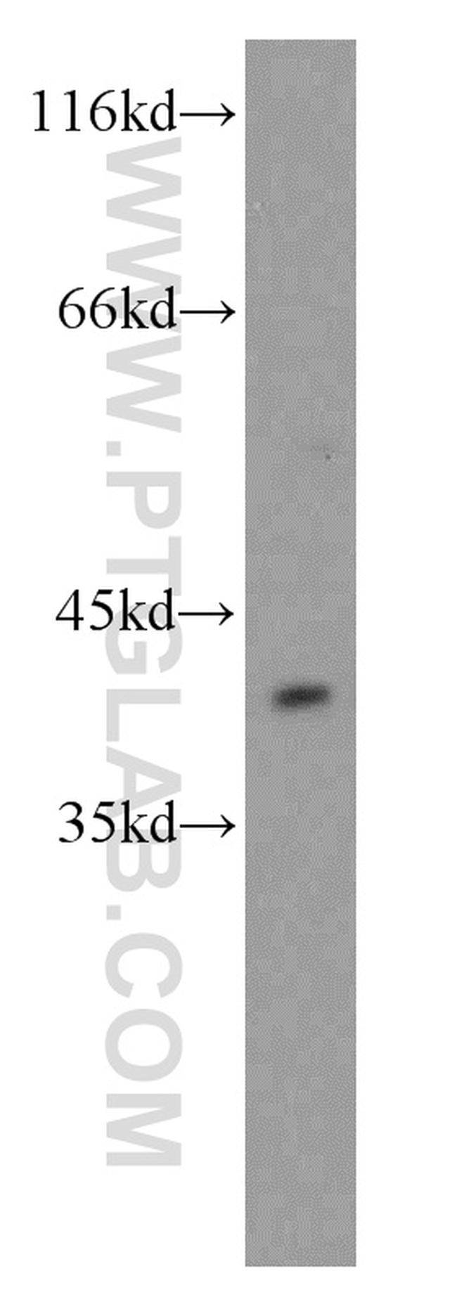 PITX1 Antibody in Western Blot (WB)