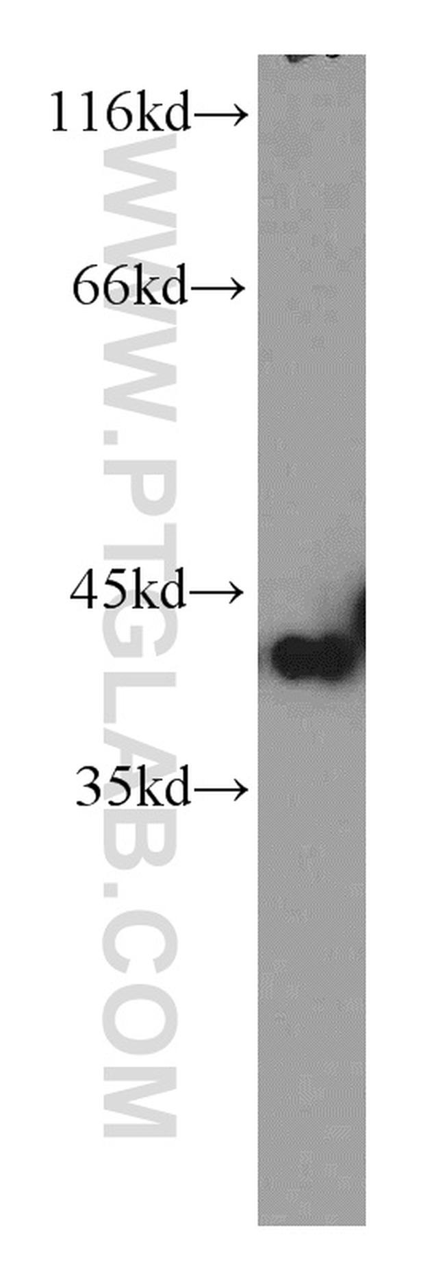PITX1 Antibody in Western Blot (WB)