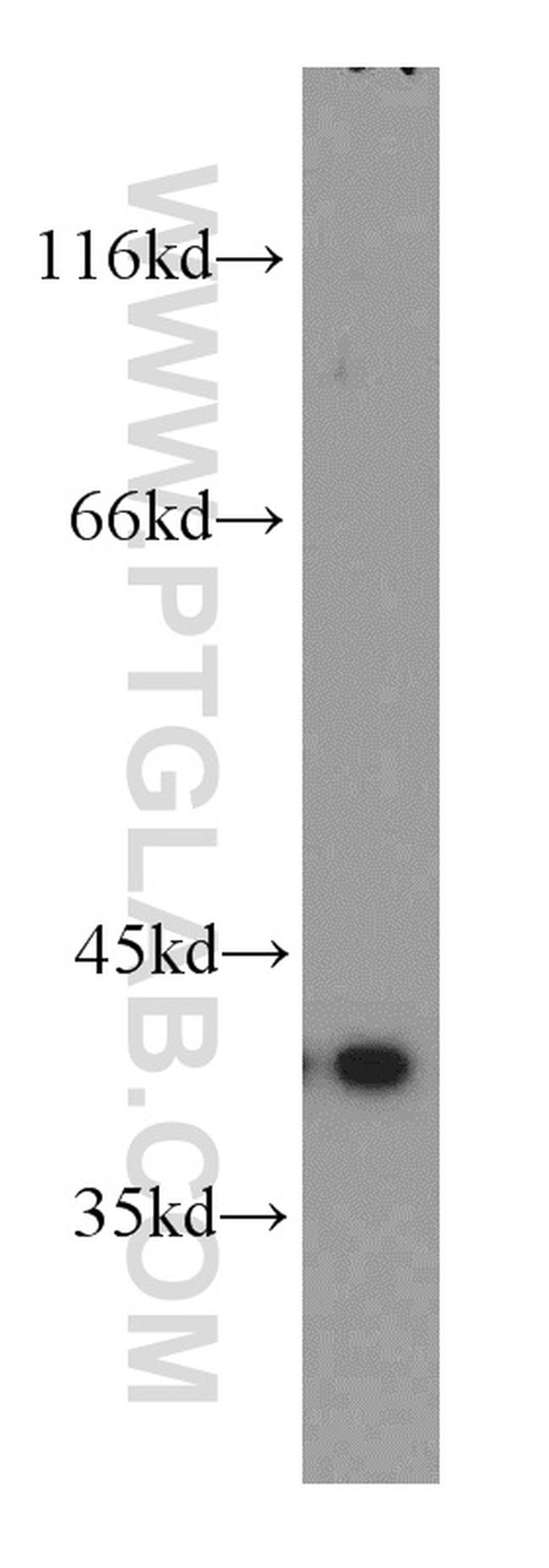 PITX1 Antibody in Western Blot (WB)