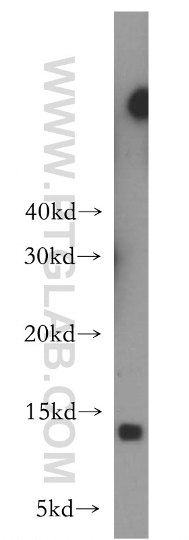 LSM10 Antibody in Western Blot (WB)