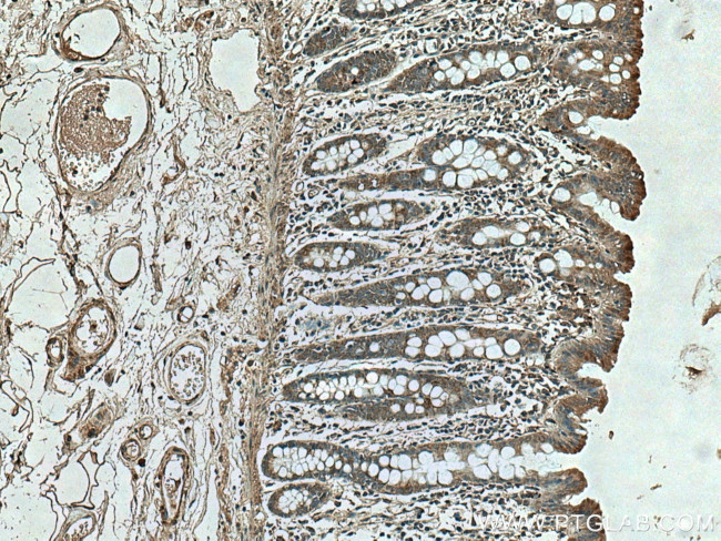 HSP47 Antibody in Immunohistochemistry (Paraffin) (IHC (P))