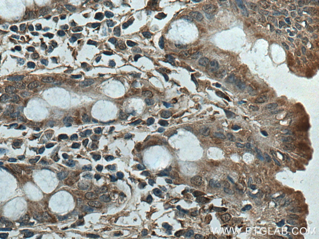 HSP47 Antibody in Immunohistochemistry (Paraffin) (IHC (P))