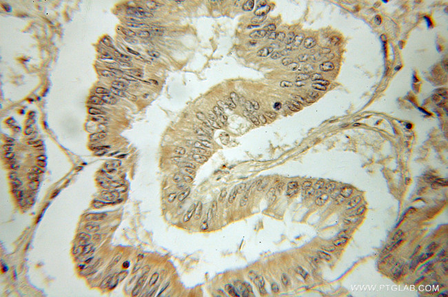 PRELID1 Antibody in Immunohistochemistry (Paraffin) (IHC (P))