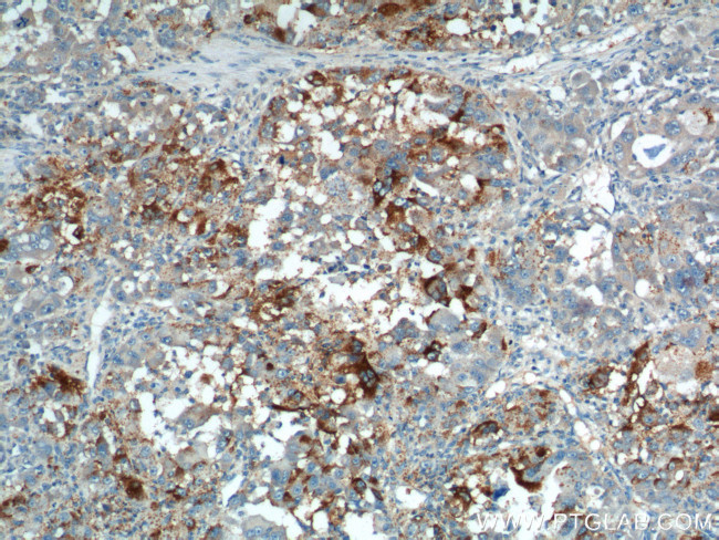 PRELID1 Antibody in Immunohistochemistry (Paraffin) (IHC (P))