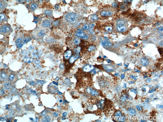 PRELID1 Antibody in Immunohistochemistry (Paraffin) (IHC (P))