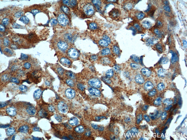 PRELID1 Antibody in Immunohistochemistry (Paraffin) (IHC (P))