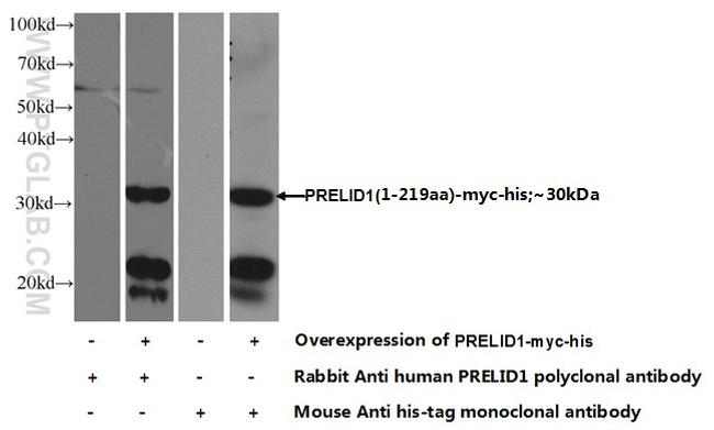 PRELID1 Antibody in Western Blot (WB)