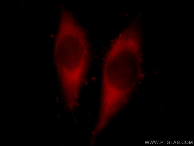 PTGES2 Antibody in Immunocytochemistry (ICC/IF)