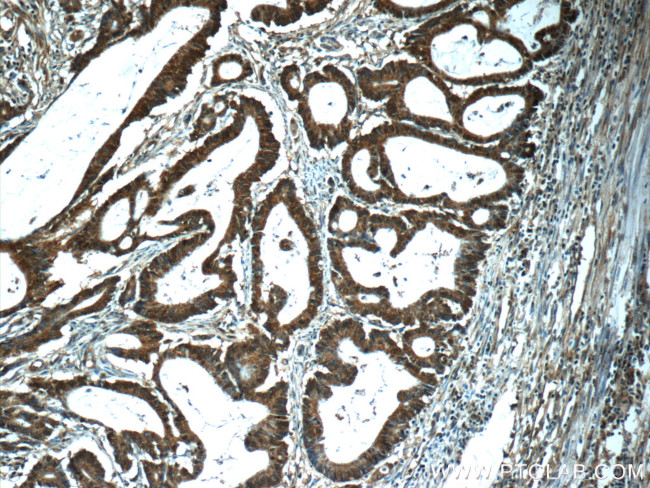 PTGES2 Antibody in Immunohistochemistry (Paraffin) (IHC (P))