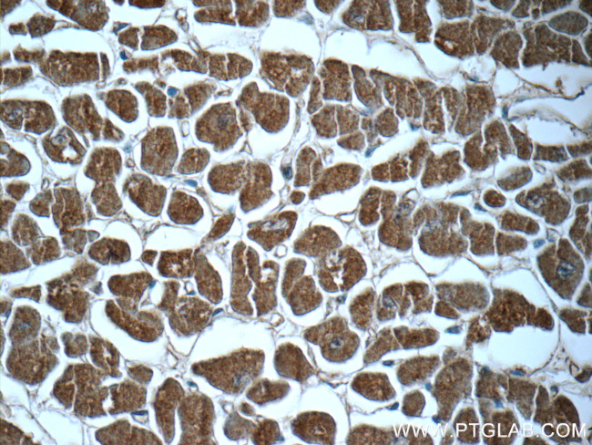 PTGES2 Antibody in Immunohistochemistry (Paraffin) (IHC (P))