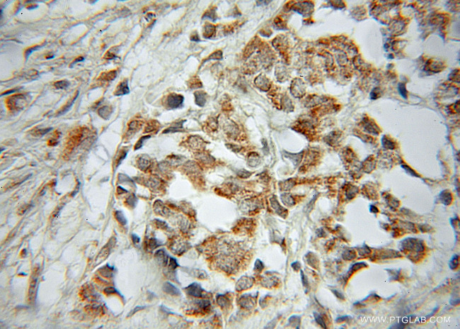 PTGES2 Antibody in Immunohistochemistry (Paraffin) (IHC (P))