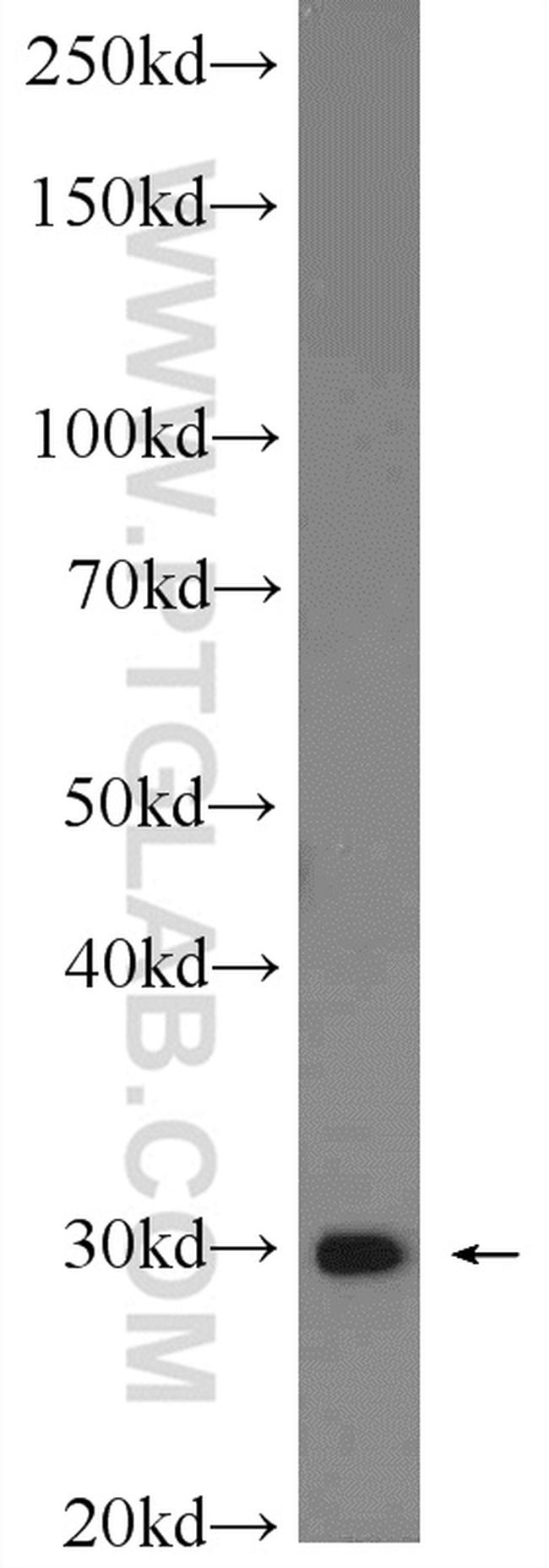 PTGES2 Antibody in Western Blot (WB)