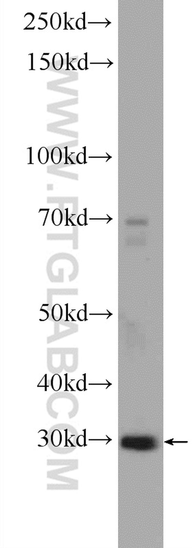 PTGES2 Antibody in Western Blot (WB)