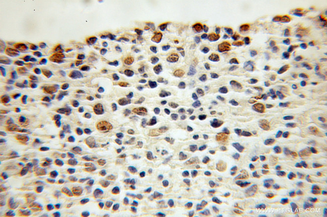 P16-INK4A Antibody in Immunohistochemistry (Paraffin) (IHC (P))