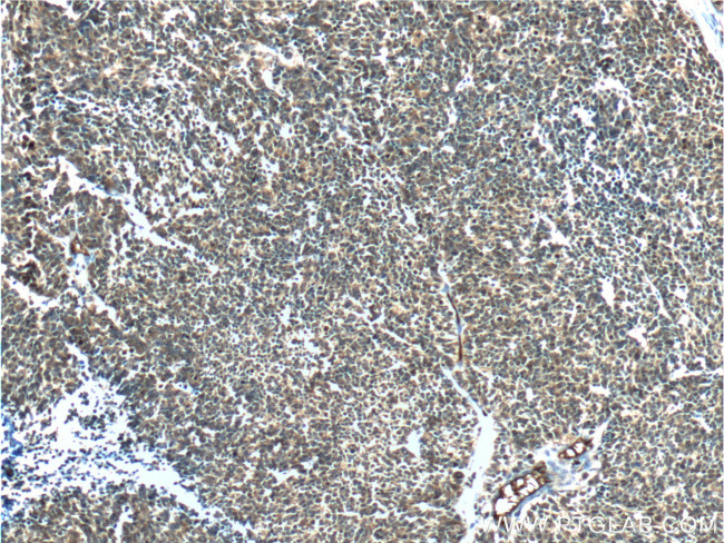 P16-INK4A Antibody in Immunohistochemistry (Paraffin) (IHC (P))