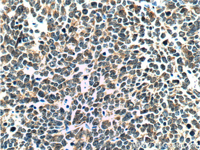 P16-INK4A Antibody in Immunohistochemistry (Paraffin) (IHC (P))