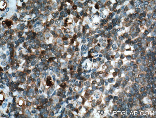 P16-INK4A Antibody in Immunohistochemistry (Paraffin) (IHC (P))