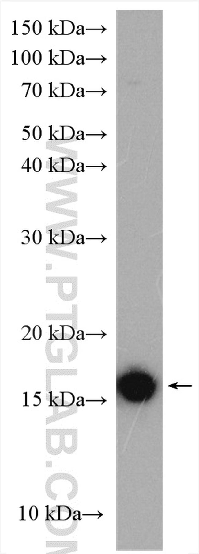 P16-INK4A Antibody in Western Blot (WB)