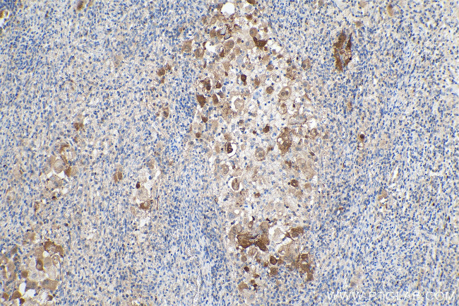 P16-INK4A Antibody in Immunohistochemistry (Paraffin) (IHC (P))