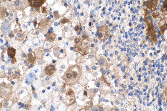 P16-INK4A Antibody in Immunohistochemistry (Paraffin) (IHC (P))