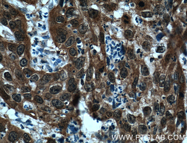 P16-INK4A Antibody in Immunohistochemistry (Paraffin) (IHC (P))