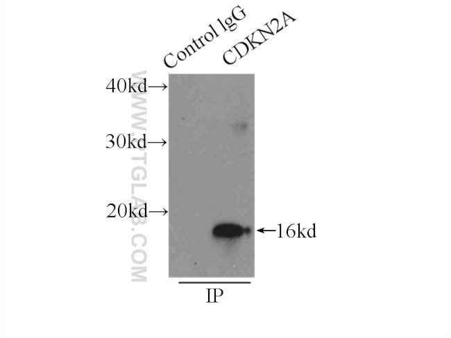 P16-INK4A Antibody in Immunoprecipitation (IP)