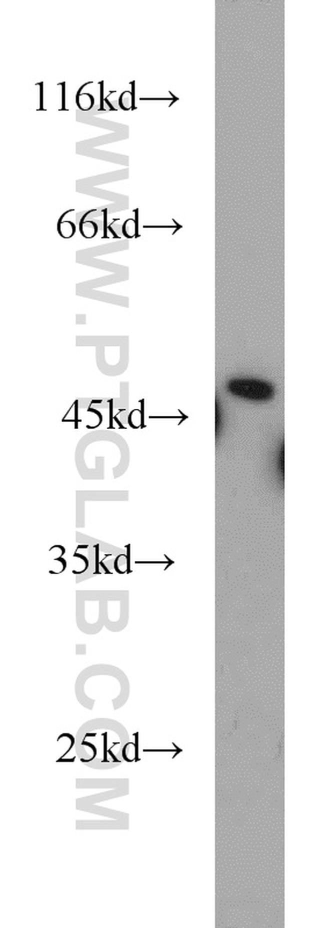 ETF1 Antibody in Western Blot (WB)