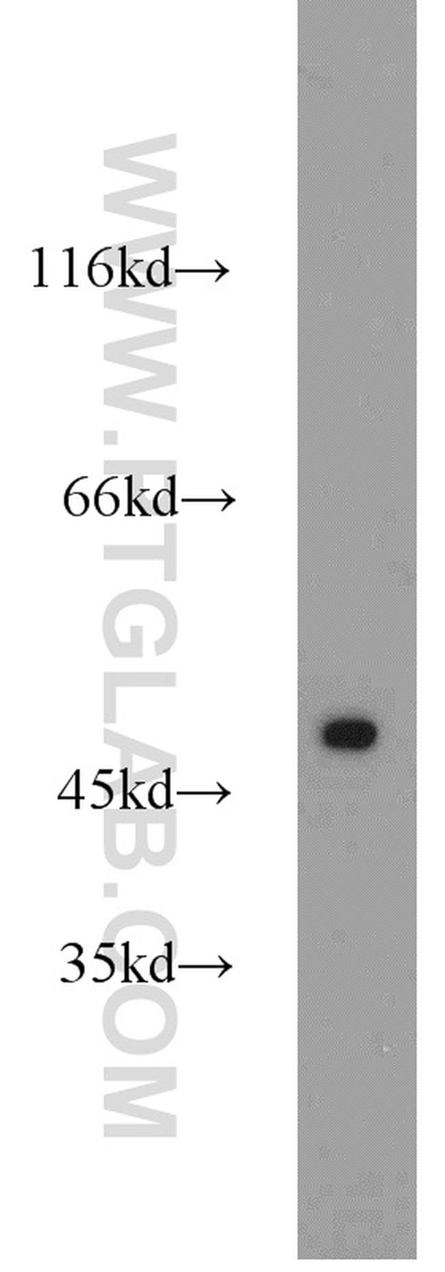 ETF1 Antibody in Western Blot (WB)