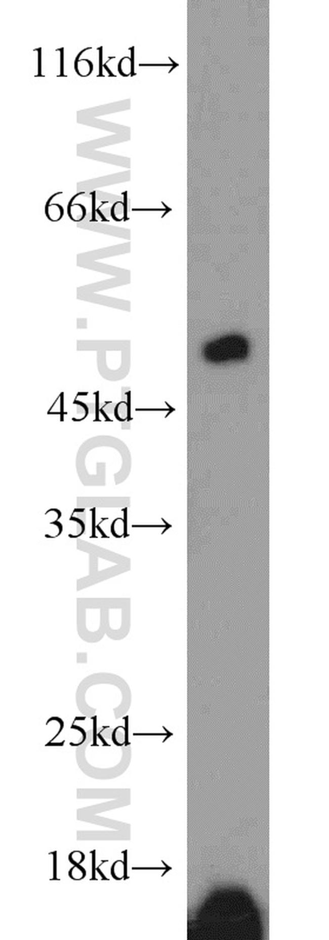 ETF1 Antibody in Western Blot (WB)