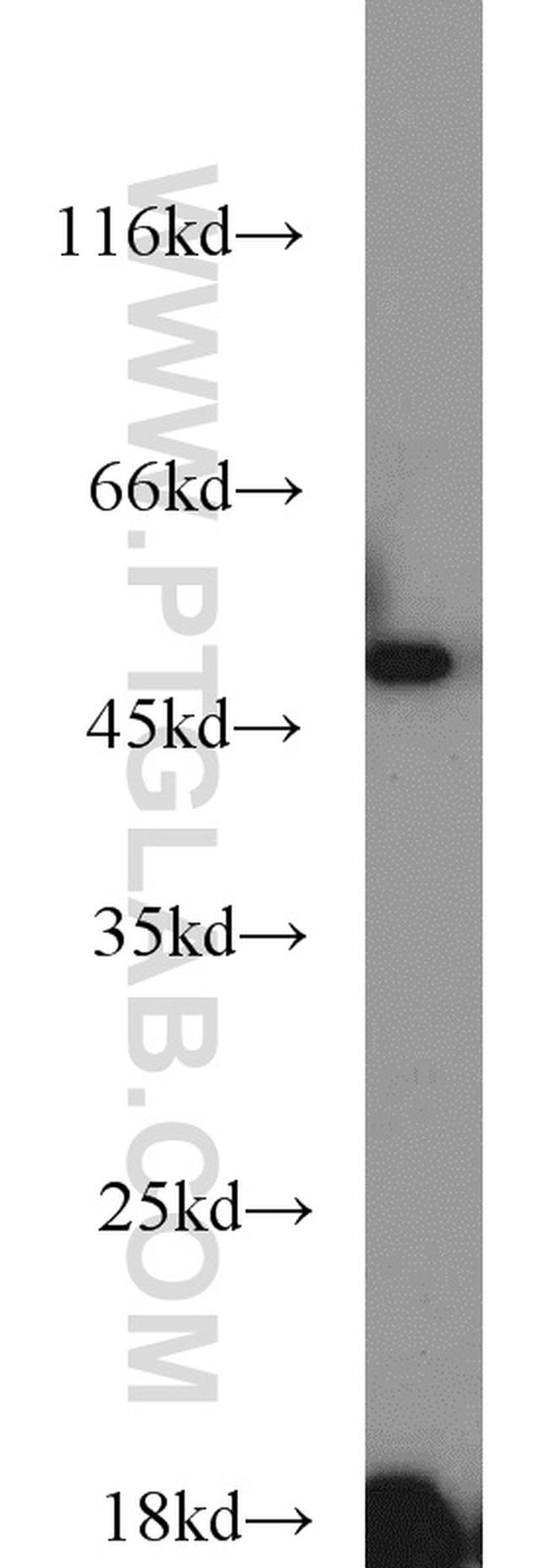 ETF1 Antibody in Western Blot (WB)