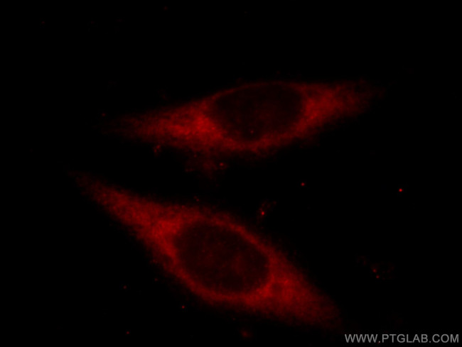 ETF1 Antibody in Immunocytochemistry (ICC/IF)