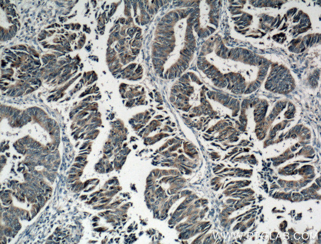 Syndecan-3 Antibody in Immunohistochemistry (Paraffin) (IHC (P))