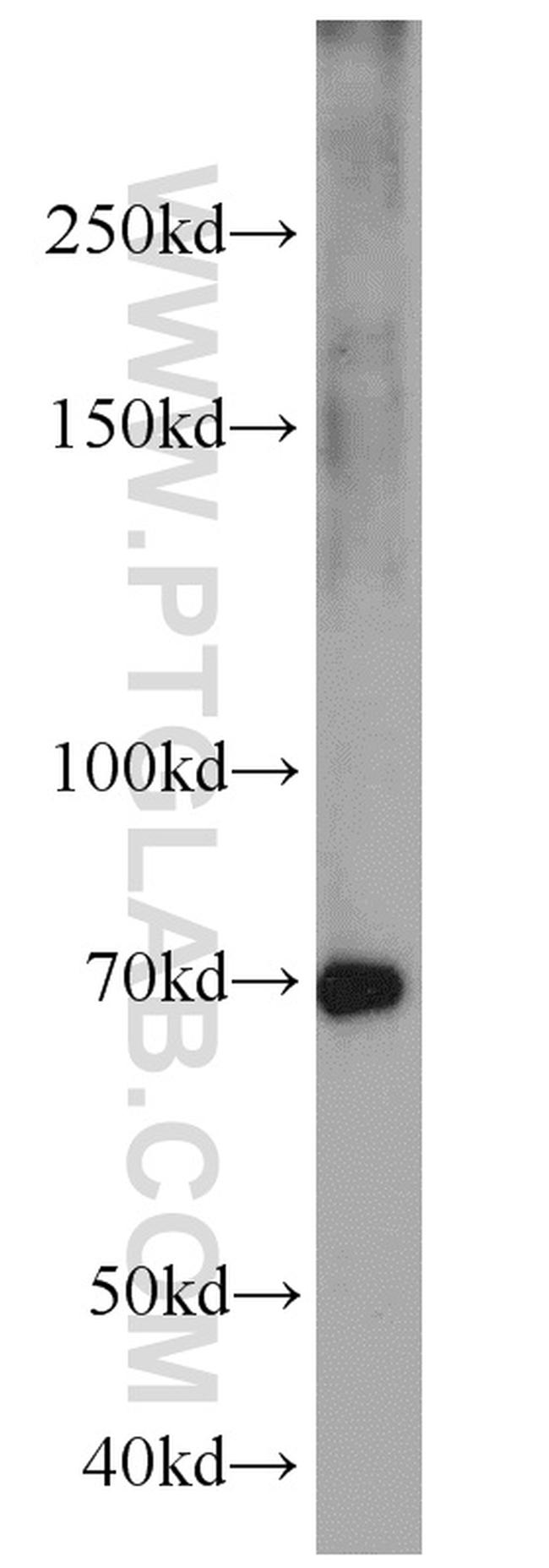 Syndecan-3 Antibody in Western Blot (WB)
