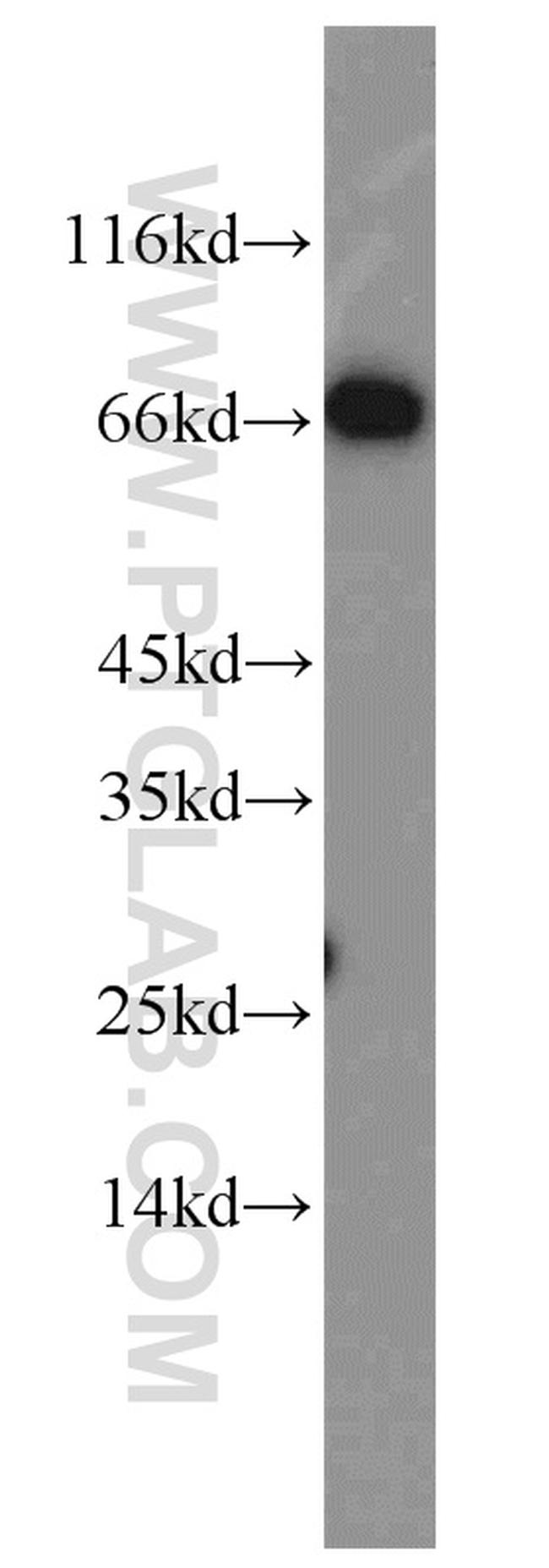 Syndecan-3 Antibody in Western Blot (WB)