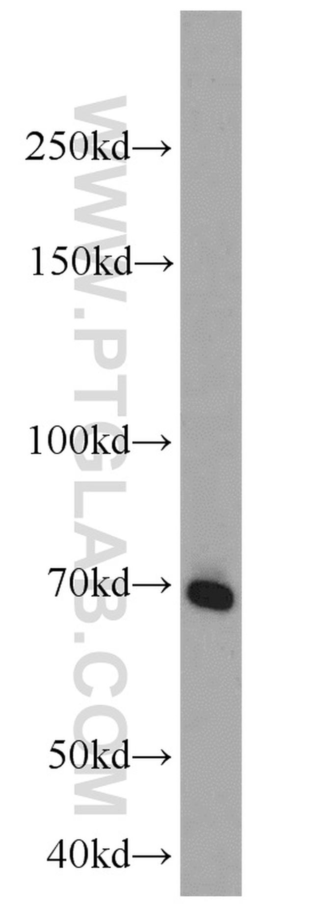 Syndecan-3 Antibody in Western Blot (WB)