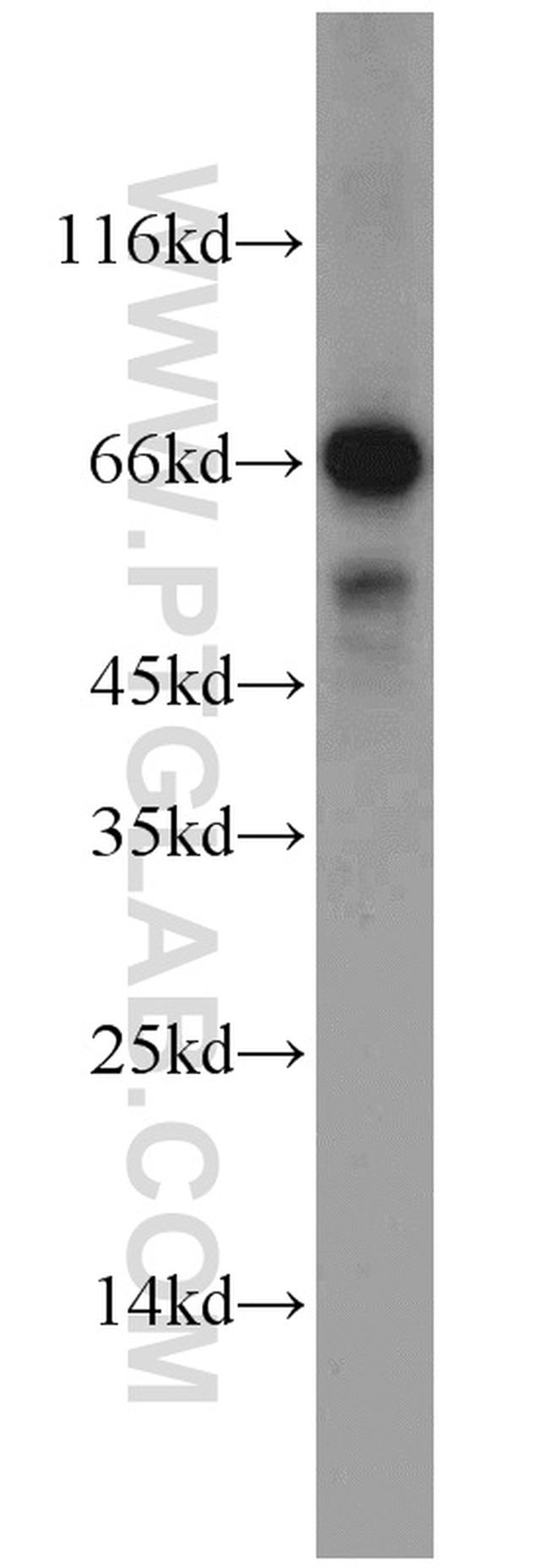 Syndecan-3 Antibody in Western Blot (WB)