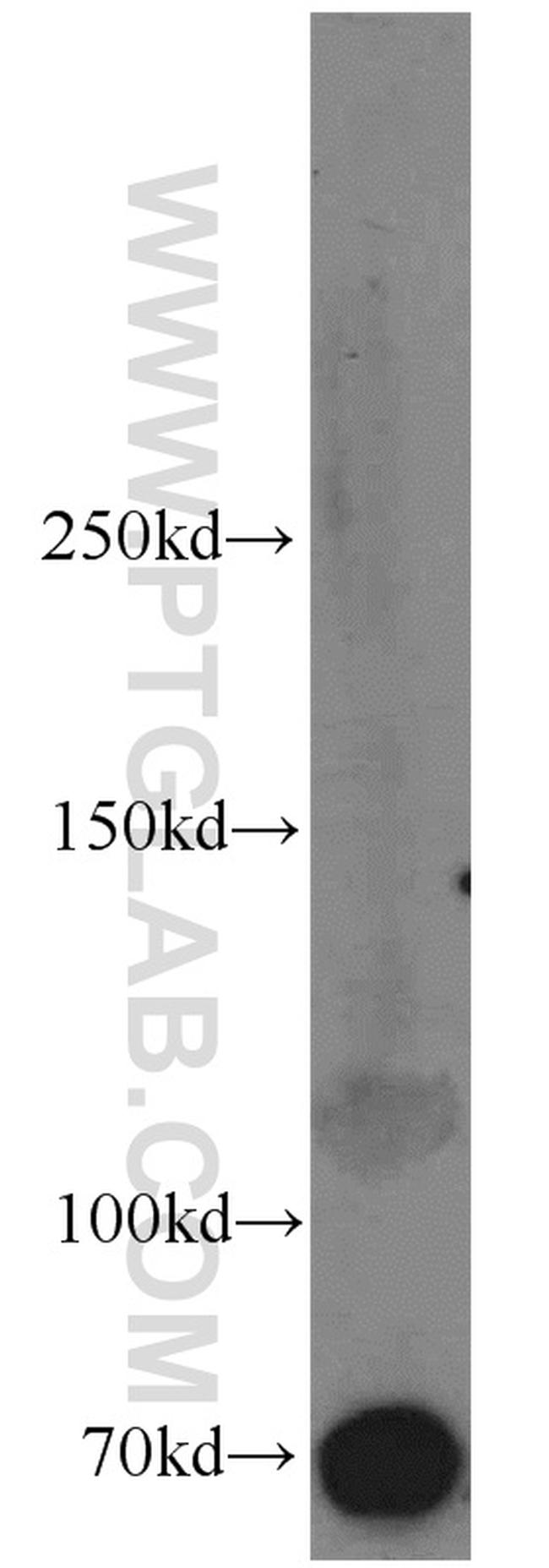 Syndecan-3 Antibody in Western Blot (WB)