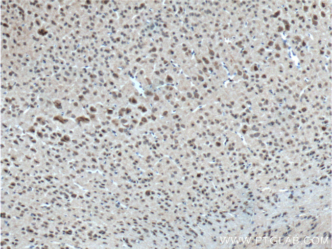 neuromedin B Antibody in Immunohistochemistry (Paraffin) (IHC (P))