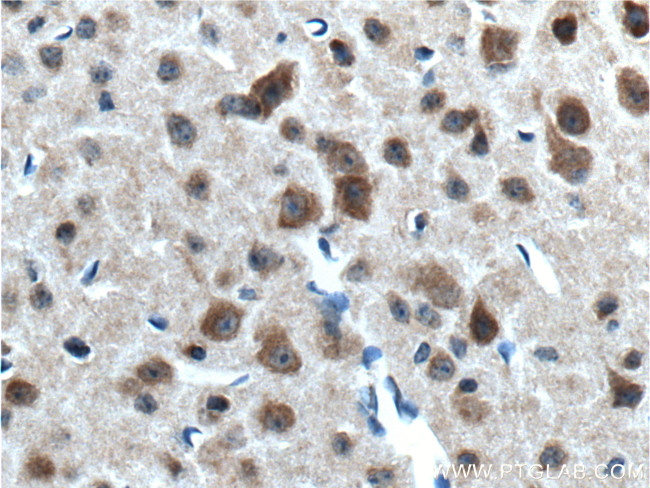 neuromedin B Antibody in Immunohistochemistry (Paraffin) (IHC (P))